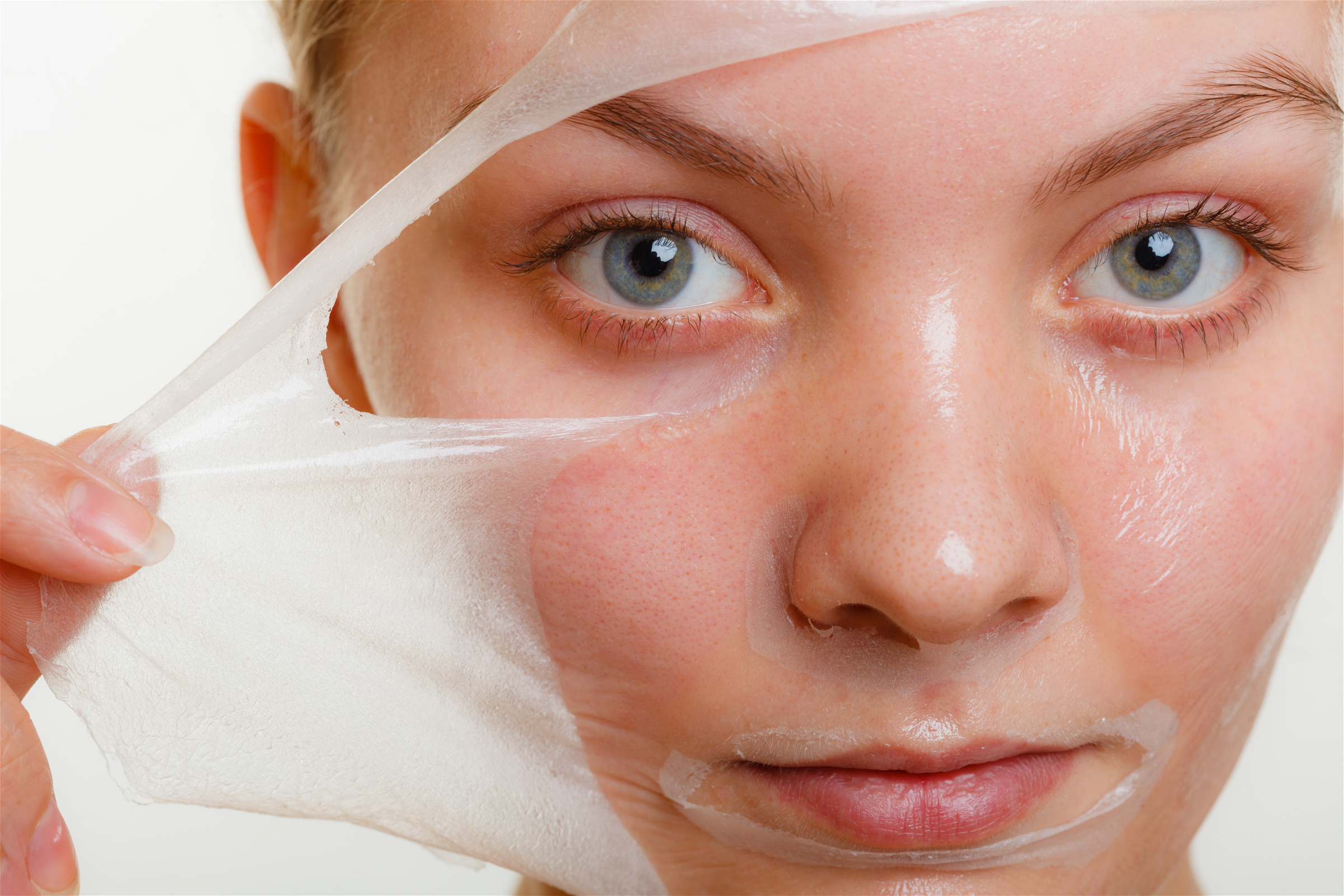 Everything You Need To Know About Chemical Peels