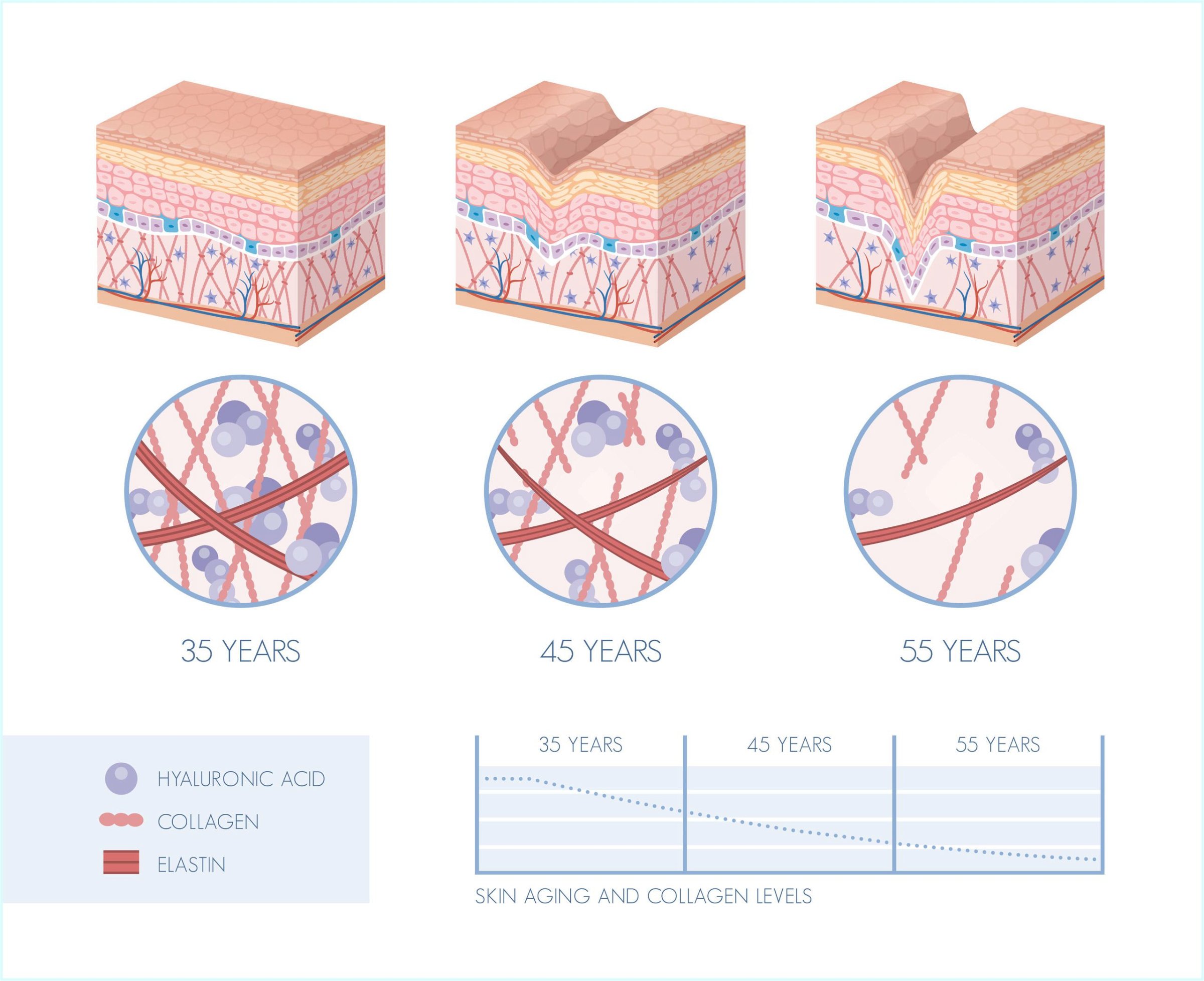 Graphic depicting collagen, elastin, and hyaluronic acid decrease in skin with age.