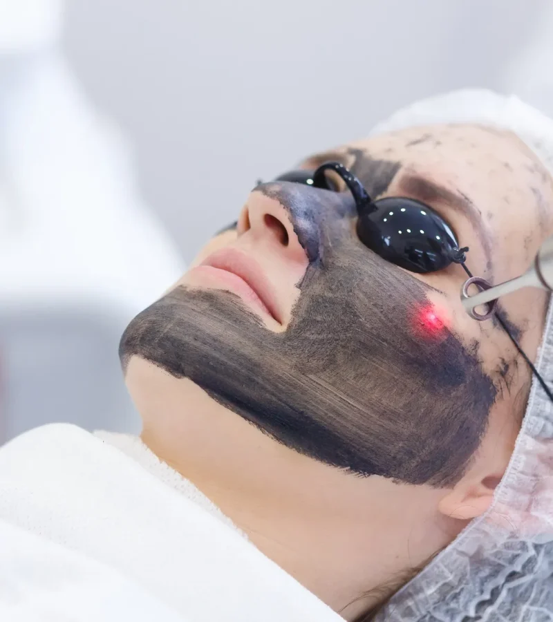 Laser Facial