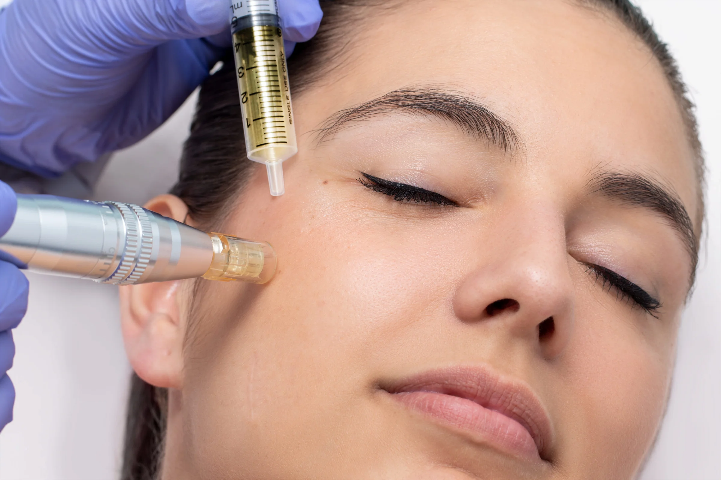 Microneedling with Human Growth Factor: Get Results
